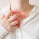 Penyebab Umum Alergi dan Cara Menghindarinya